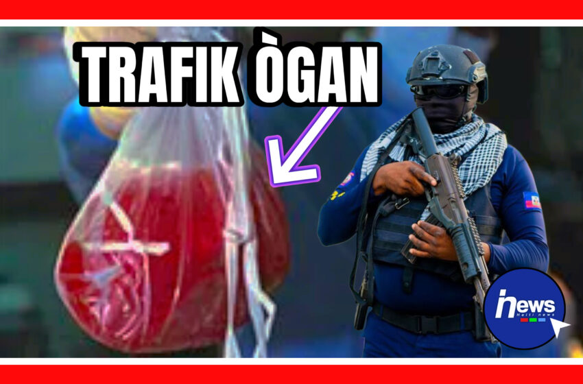  Lapolis demantle yon rezo k ap fè trafik ògàn nan peyi a